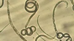 速來認(rèn)識下松材線蟲及海關(guān)的檢驗(yàn)檢疫要求！